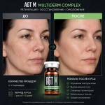 Multiderm Complex AGT М