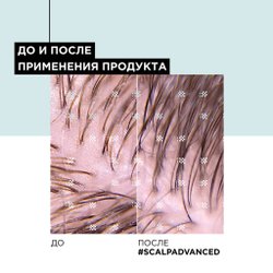 L'Oreal Скальп Анти-Ойл шампунь 300мл