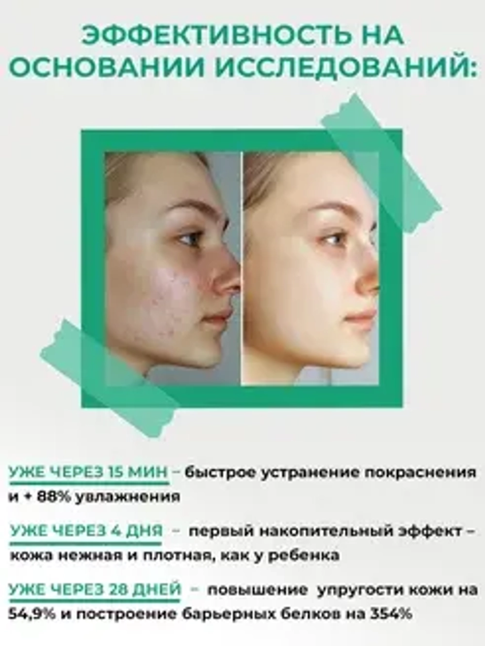 Восстанавливающая маска с гиалуроновой кислотой | BIOHYALUX Barrier Conditioning Mask, 5*30 гр
