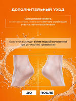 150мл Теймурова спрей для ног мужской/женский, от запаха и пота с салициловой кислотой, против обильного потоотделения и гипергидроза / антибактериальный антиперспирант, дезодорант