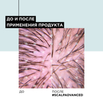 ЛП СЭ Скальп Анти-Дискомф шампунь 500мл ( E3848000 )