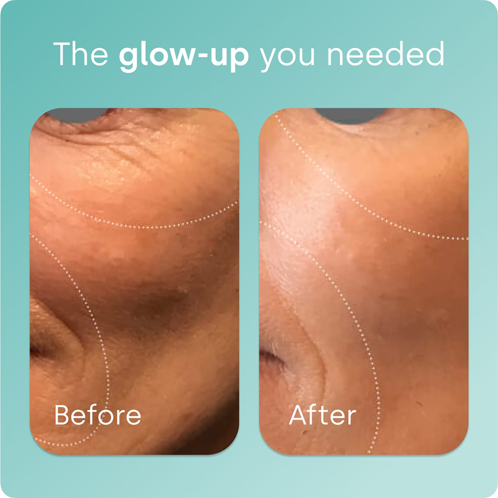 Biosil, Advanced Collagen Generator®, средство для стимулирования производства коллагена, 120 оригинальных капсул