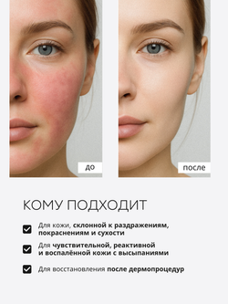 СЫВОРОТКА ДЛЯ ЧУВСТВИТЕЛЬНОЙ И РЕАКТИВНОЙ КОЖИ