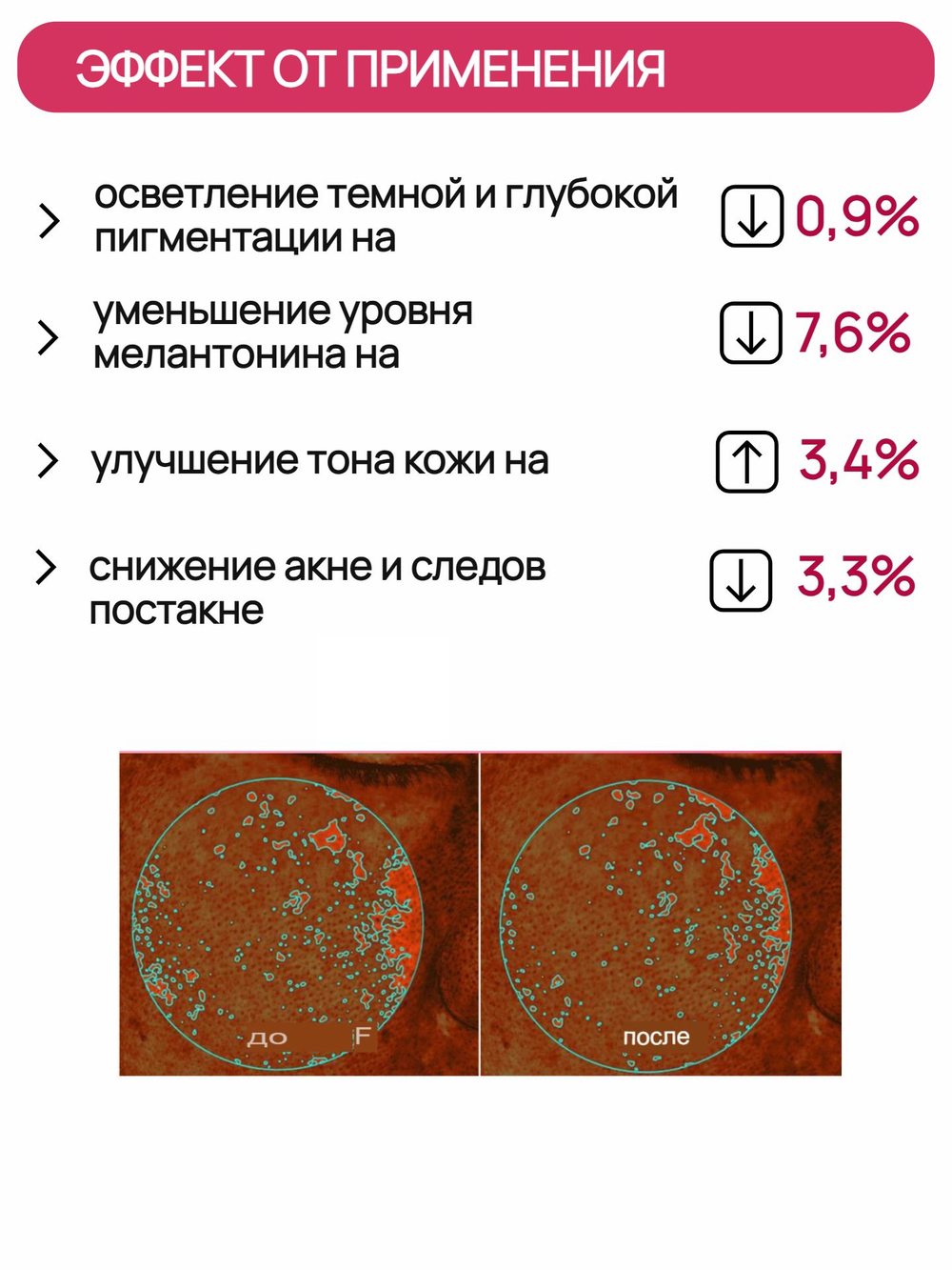 AprilSkin Тонер молочный осветляющий TXA Niacinamide 99 Milky Toner 150 мл