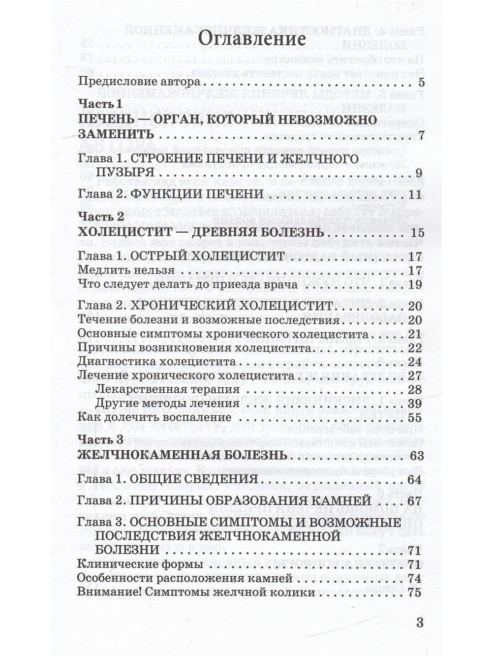 Холецистит и другие болезни желчного пузыря