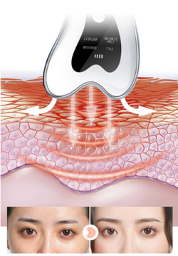 MOMMY CARE Микротоковый гуаша-массажер Galvanic RF Massager
