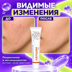 АЗЕЛОДЖИ 10% гелі