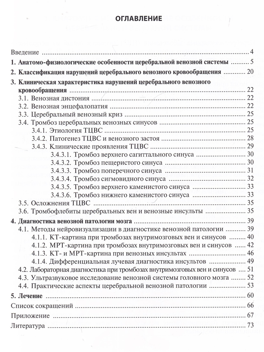 Церебральные венозные нарушения