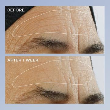 Сыворотка с ретинолом Perricone MD High Potency Triple Retinol Renewal Serum
