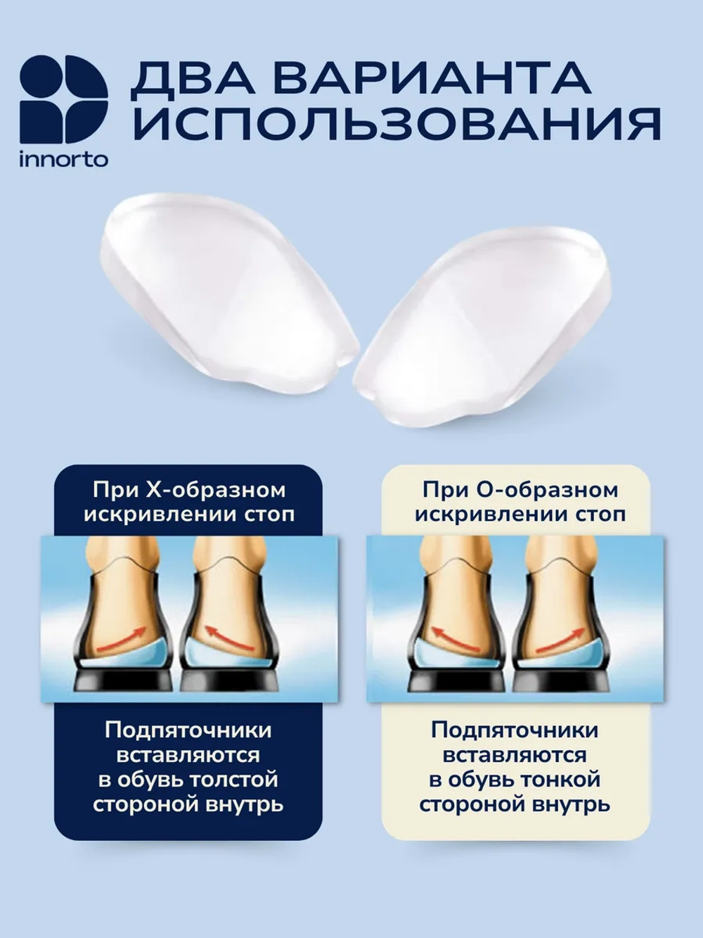 Подпяточник при вальгусной деформации