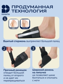 Вальгусные шины от косточки на большом пальце