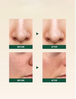 K-SECRET [Повредилась упаковка] Seoul 1988 Cleansing Foam: Pine Cica 1% + Probiotics (150 мл)