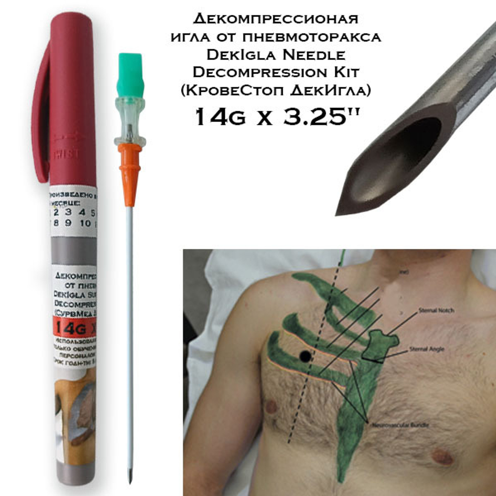 Декомпрессионая игла DekIgla Needle Decompression Kit КровеСтоп 14gx3.25"