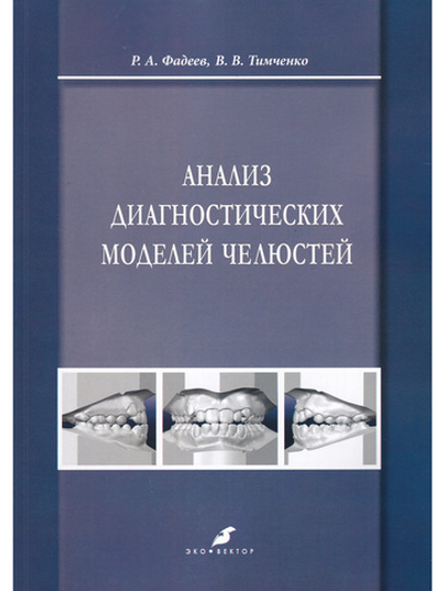 Анализ диагностических моделей челюстей