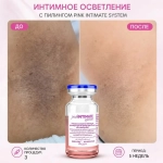 Pink Intimate System