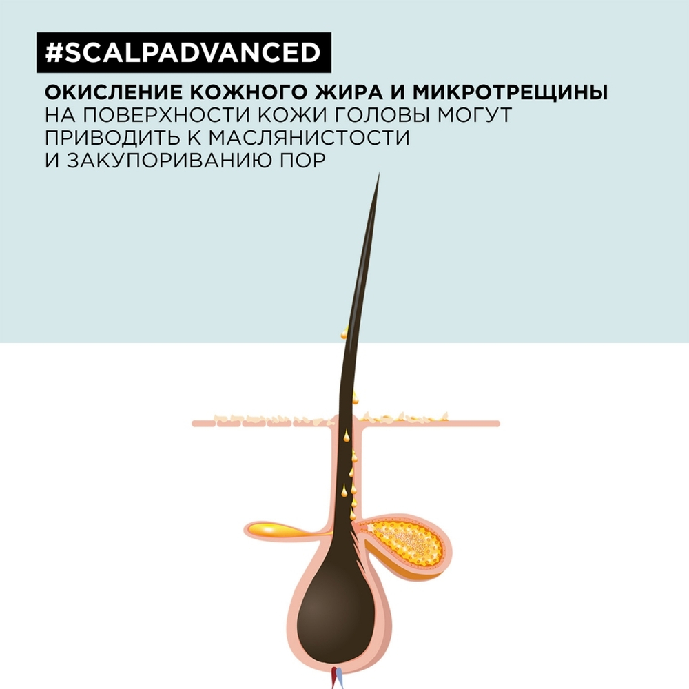 L'Oreal Скальп Анти-Ойл шампунь 300мл