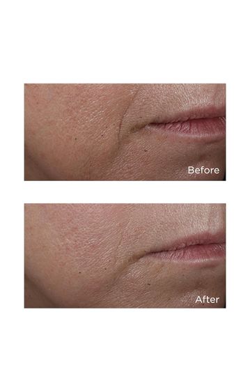 Антивозрастной крем Perricone MD Cold Plasma Plus+ Advanced Serum Concentrate