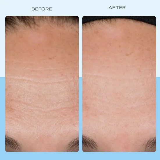 Укрепляющий крем с пептидами, ниацинамидом и коллагеном First Aid Beauty Firming Cream