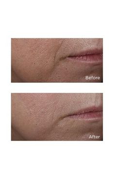 Антивозрастной крем Perricone MD Cold Plasma Plus+ Advanced Serum Concentrate