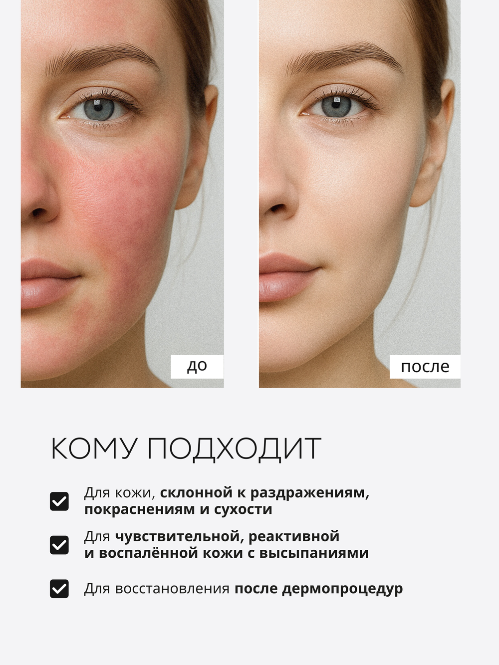 СЫВОРОТКА ДЛЯ ЧУВСТВИТЕЛЬНОЙ И РЕАКТИВНОЙ КОЖИ LAURA ZACKARYA — 2% ЭКТОИН И 2% СКВАЛАН