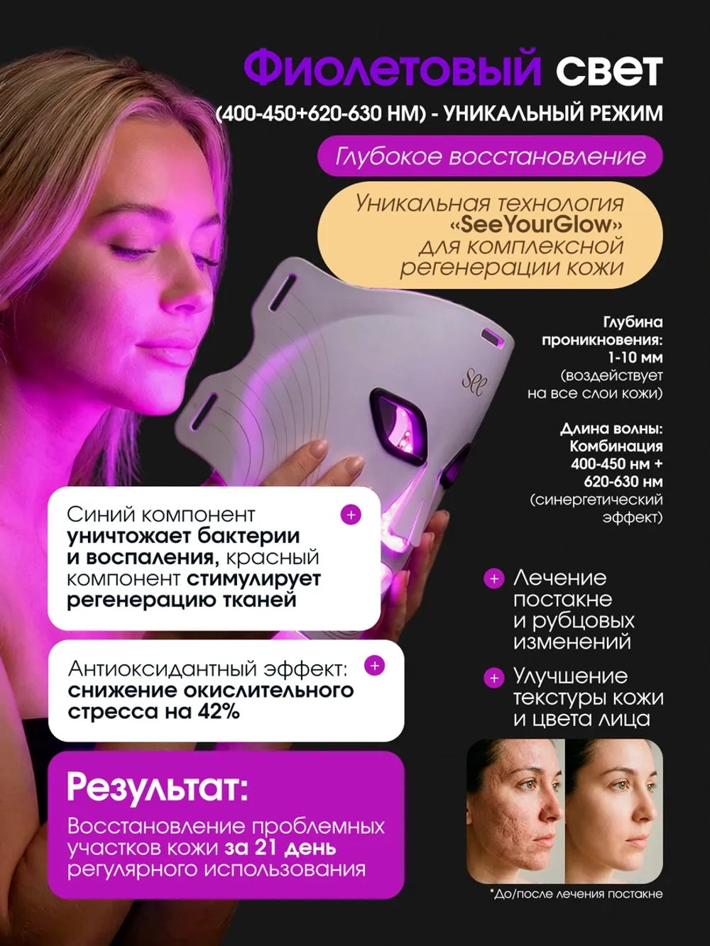 светодиодная Led маска для фототерапии лица косметическая