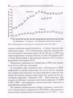 Туберкулез глаз и сходные с ним заболевания. Руководство для врачей. 2е изд.