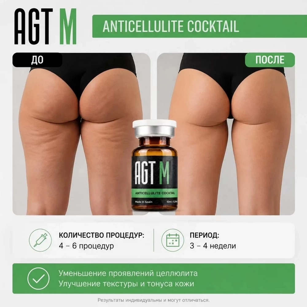 Anticellulite Coctail AGT М