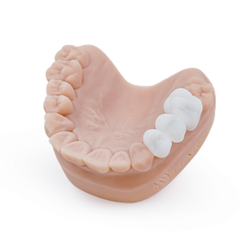 Dental Bleach