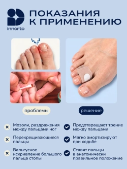 Фиксатор пальцев стопы ортопедический