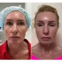 Monaco Set BioGEL | Набор 3 шт.