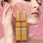 Redness Peel Inno-Exfo