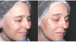 Cytocare S Line Revitacare | ГК 6мг/мл+CT50 | Биорепарант
