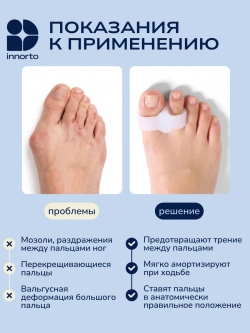 Разделитель для пальцев ног силиконовый ортопедический