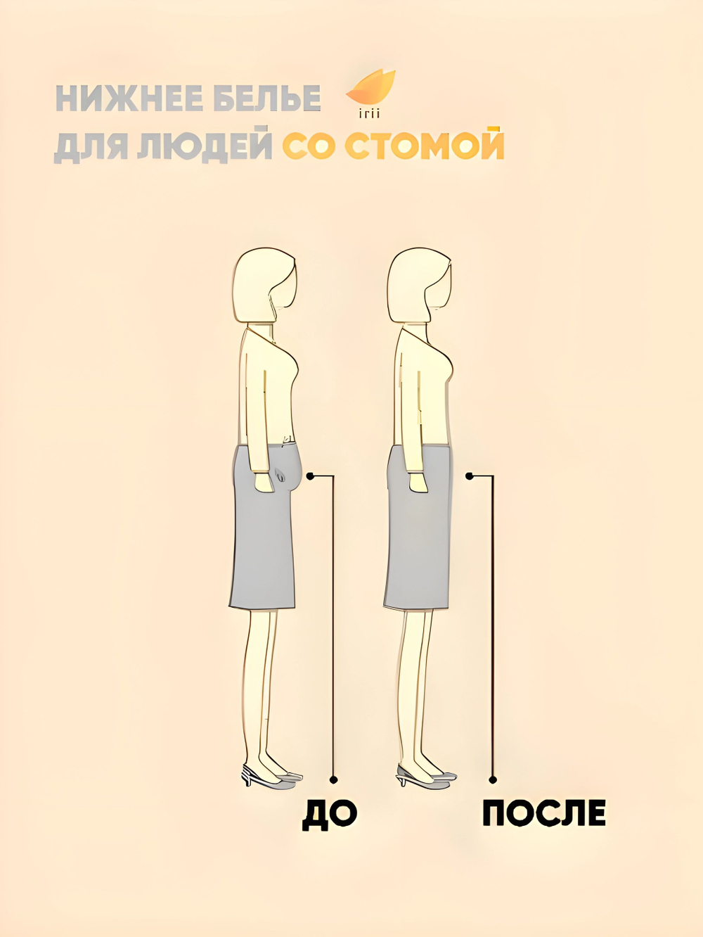 Irii Трусы мужские для людей со стомой Грей, серые