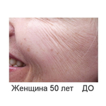 Skin-R | Реструктуризация | ГК+Аминокислоты