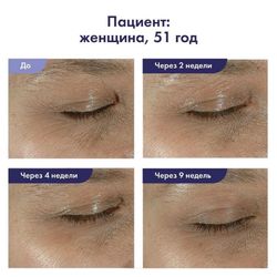 Obagi Medical Ночной крем для век Elastiderm Eye Treatment Cream, 15 гр