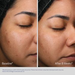 Obagi Medical Увлажняющий ночной крем с ретинолом и PHA кислотами RETINOL + PHA Refining Night Cream 50 мл