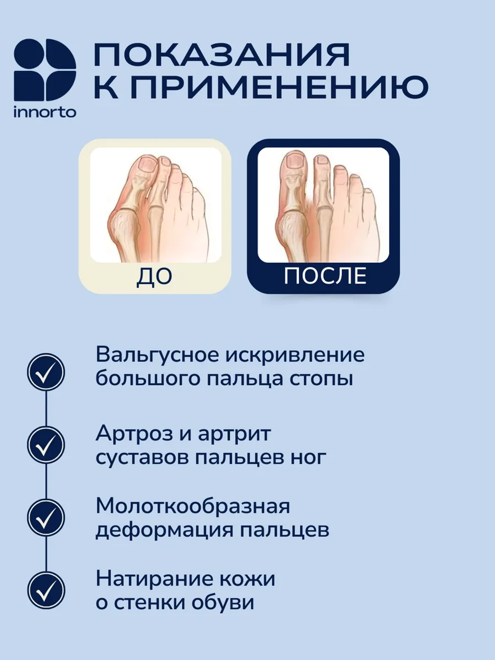 Бурсопротектор для большого пальца