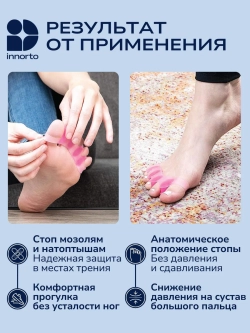 Разделители для пальцев ног