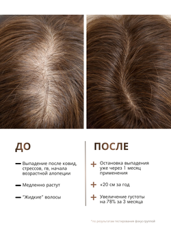Трёхступенчатая система для роста и укрепления волос GROW IT