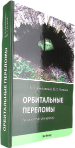 Орбитальные переломы