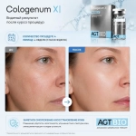 Cologenum X AGT Bio