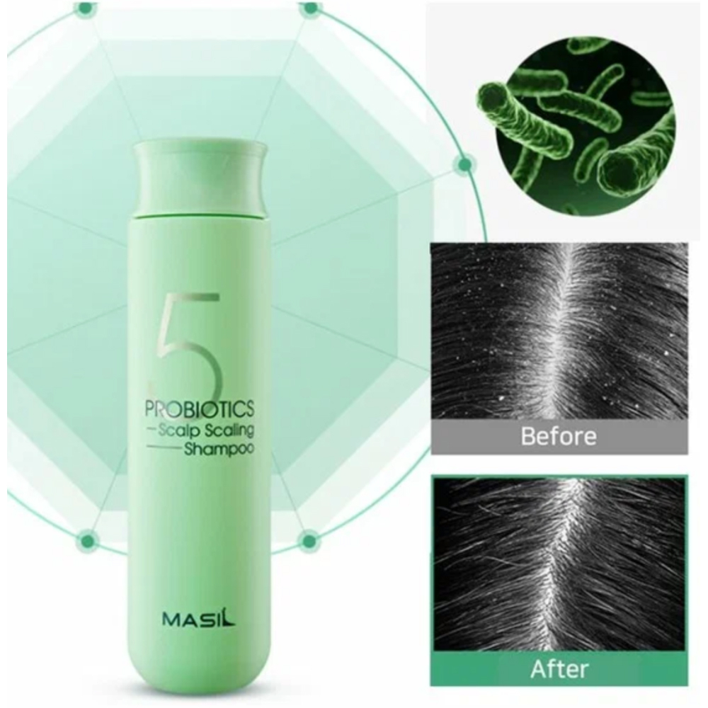 Шампунь для глубокого очищения кожи головы с пробиотиками Masil 5 Probiotics Scalp Scaling Shampoo 300 мл
