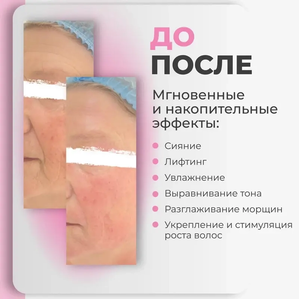 Be Young & Shine AGT Bio