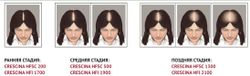 Crescina Transdermic HFSC 100% RE-GROWTH лосьон для возобновления роста волос для женщин. Дозировка 1300 / 40 ампул по 3,5 мл