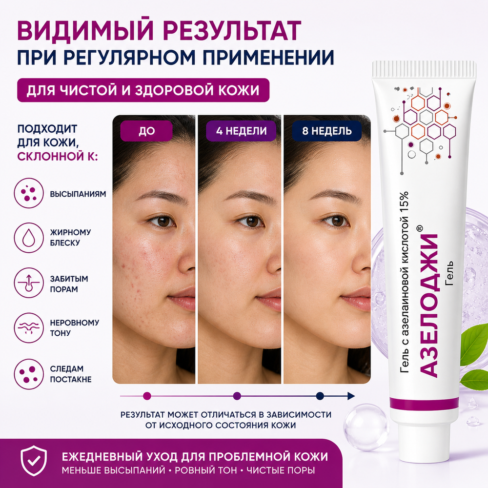 АЗЕЛОДЖИ 15% гелі