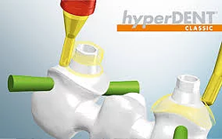 hyperDENT