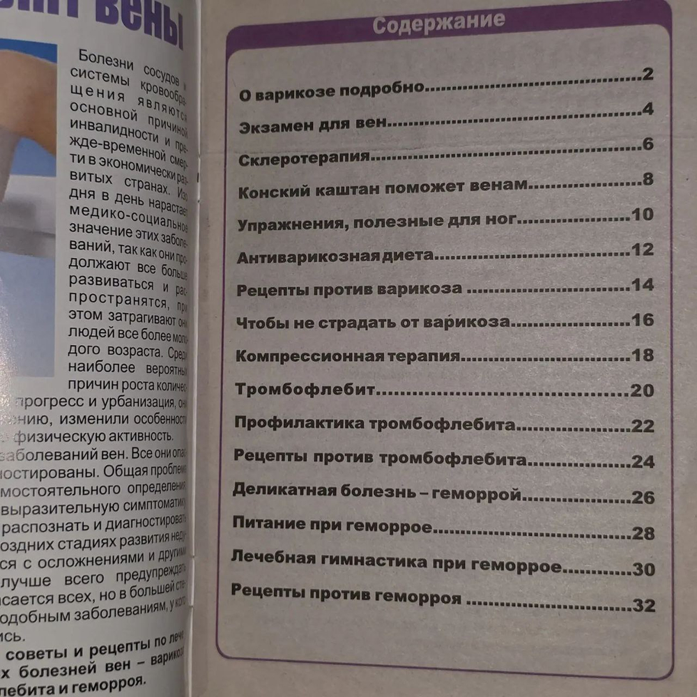 Спецвыпуски от "Будьте здоровы" № 5 (тромбофлебит,варикоз,геморрой).