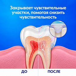 Crest Pro-Health Sensitive Relief