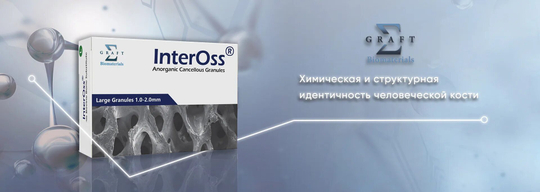 InterOss в флаконе
